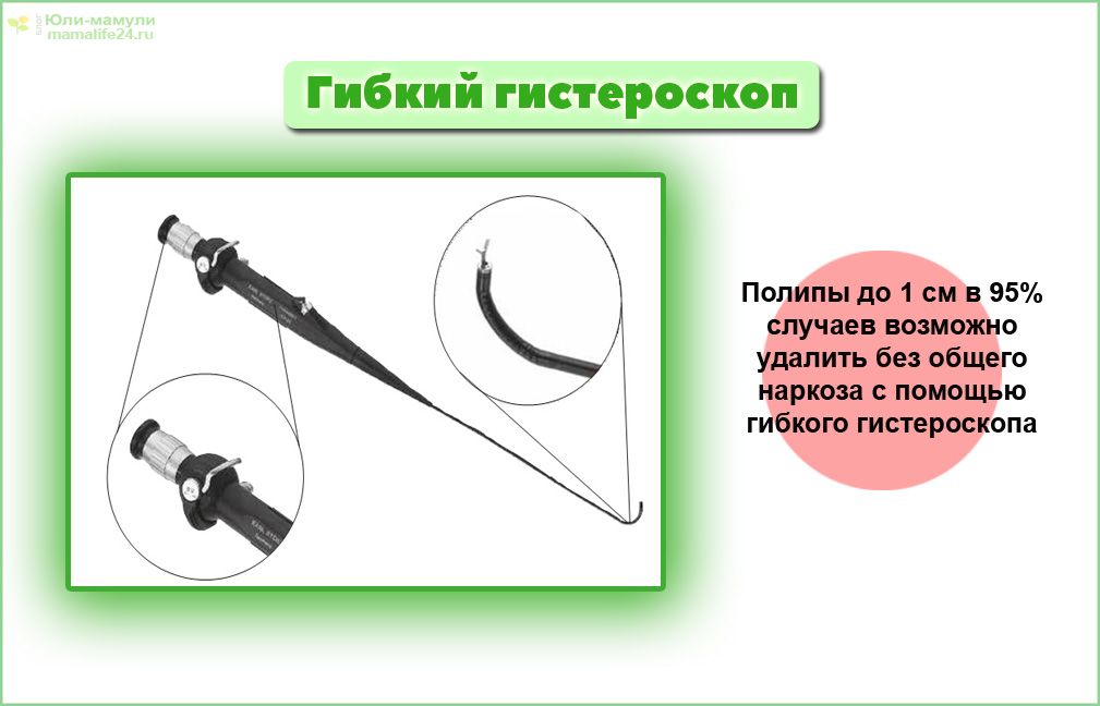 Гибкий гистероскоп фото