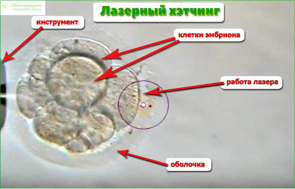 Лазерный хэтчинг фото
