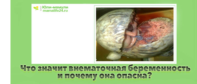Что значит внематочная беременность