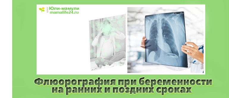 Флюорография при беременности на ранних сроках, на поздних сроках