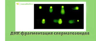 ДНК фрагментация сперматозоидов